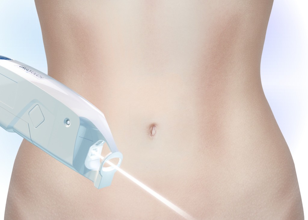 URGOTOUCH belle cicatrice après intervention de chirurgie esthétique URGOTOUCH belle cicatrice après intervention de chirurgie esthétique