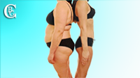 Visit the photo gallery before / after aesthetic operations on the body
