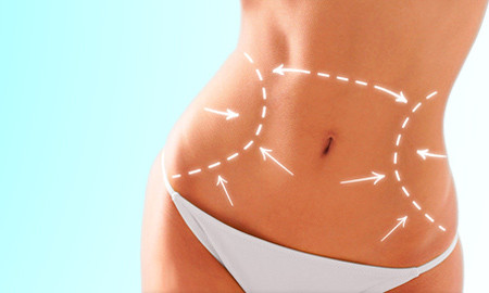 abdominoplastie-plastie-abdominale-chirurgie-esthetique-ventre.jpg