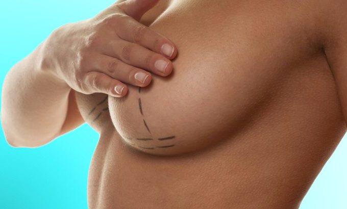 RECOMMANDATIONS-implants-mammaires.jpg