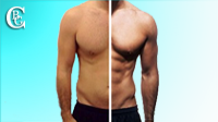 Visit the photo gallery before / after aesthetic operations for men